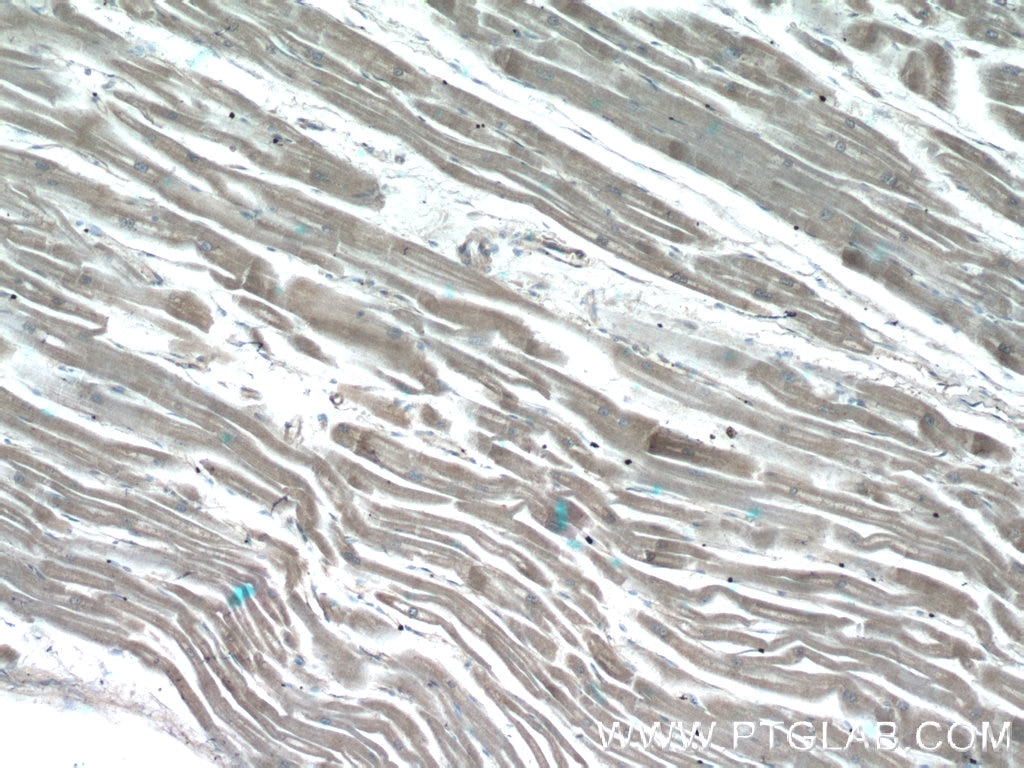 Immunohistochemistry (IHC) staining of human heart tissue using CHCHD3 Polyclonal antibody (25625-1-AP)