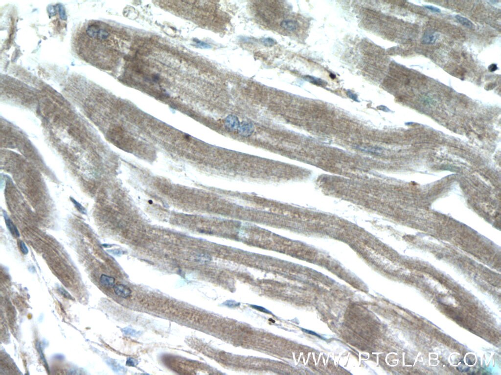 Immunohistochemistry (IHC) staining of human heart tissue using CHCHD3 Polyclonal antibody (25625-1-AP)