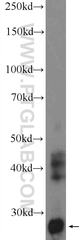 Western Blot (WB) analysis of human placenta tissue using CHCHD3 Polyclonal antibody (25625-1-AP)