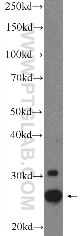 WB analysis of A431 using 25625-1-AP