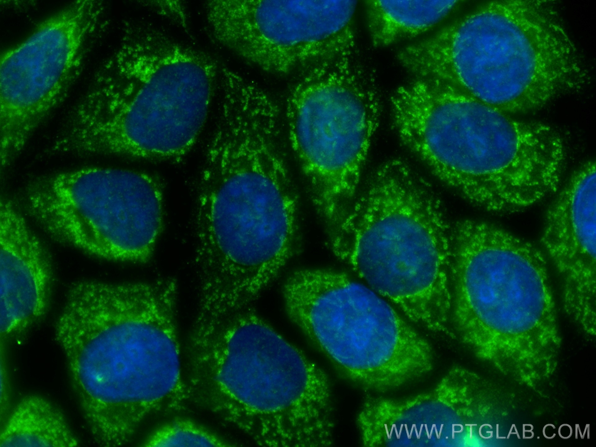 Immunofluorescence (IF) / fluorescent staining of MCF-7 cells using CHCHD3 Monoclonal antibody (68259-1-Ig)