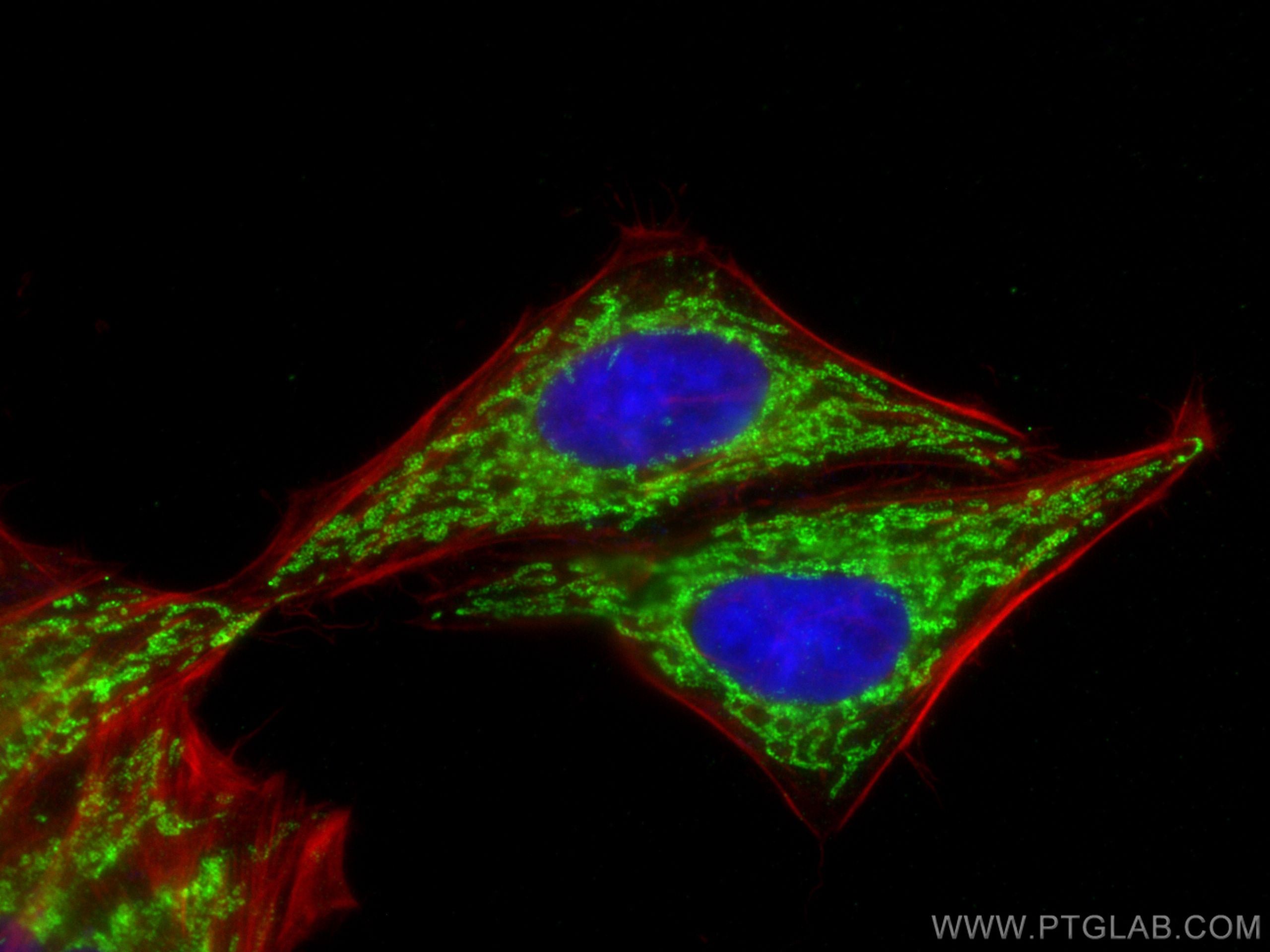 Immunofluorescence (IF) / fluorescent staining of HepG2 cells using CHCHD3 Recombinant antibody (82743-1-RR)