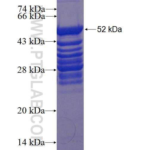 CHCHD3 fusion protein Ag22579 SDS-PAGE