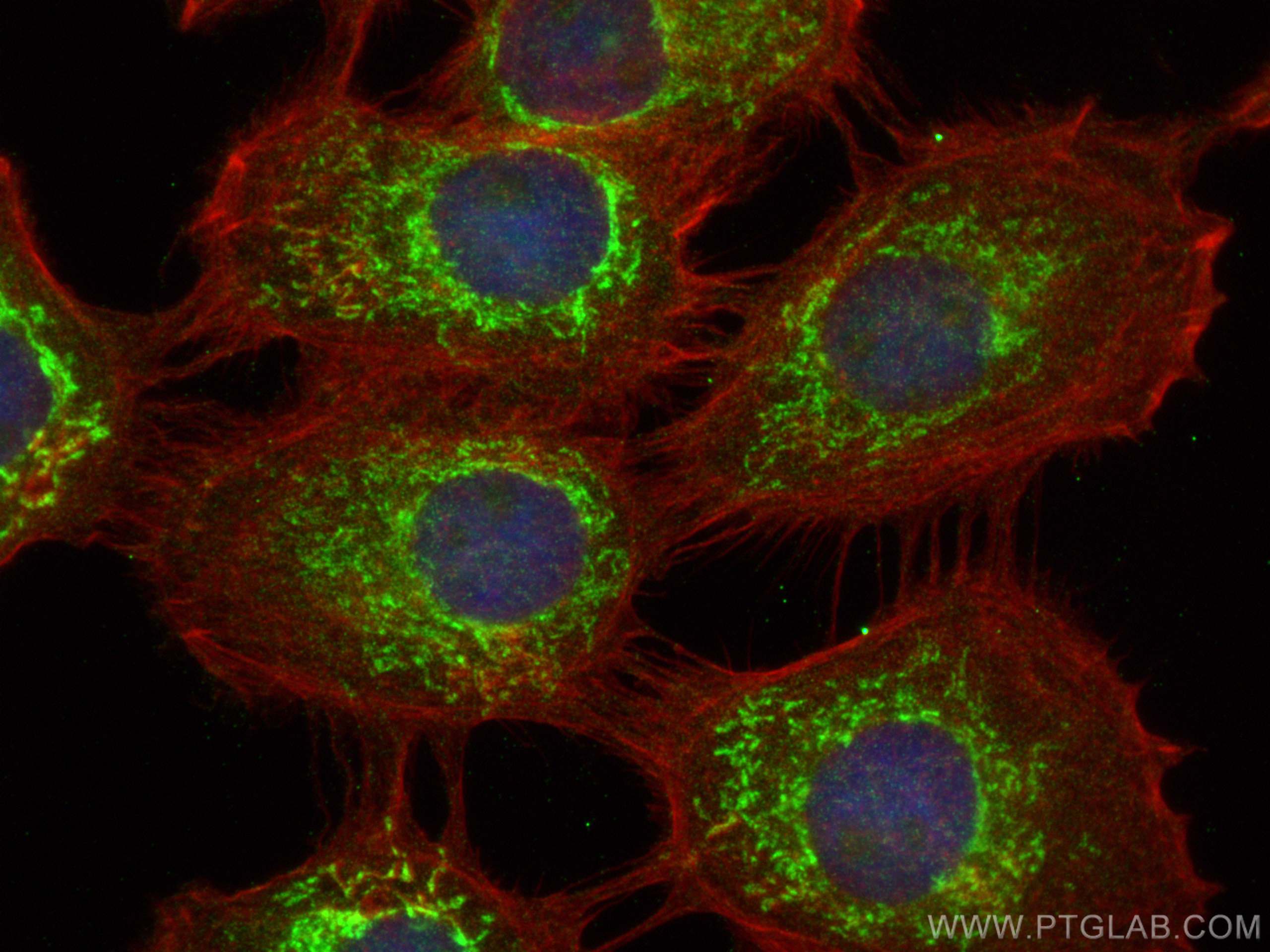 Immunofluorescence (IF) / fluorescent staining of A431 cells using CHCHD4 Polyclonal antibody (21090-1-AP)