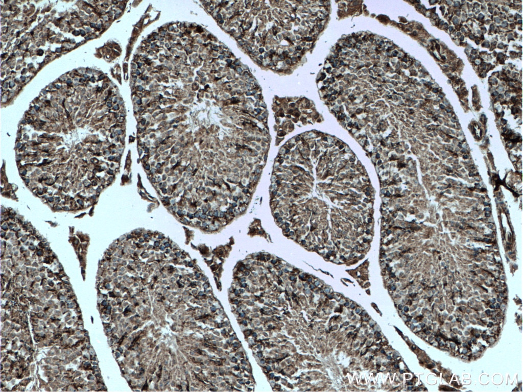 Immunohistochemistry (IHC) staining of mouse testis tissue using CHCHD4 Polyclonal antibody (21090-1-AP)