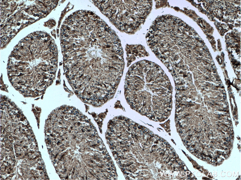 IHC staining of mouse testis using 21090-1-AP