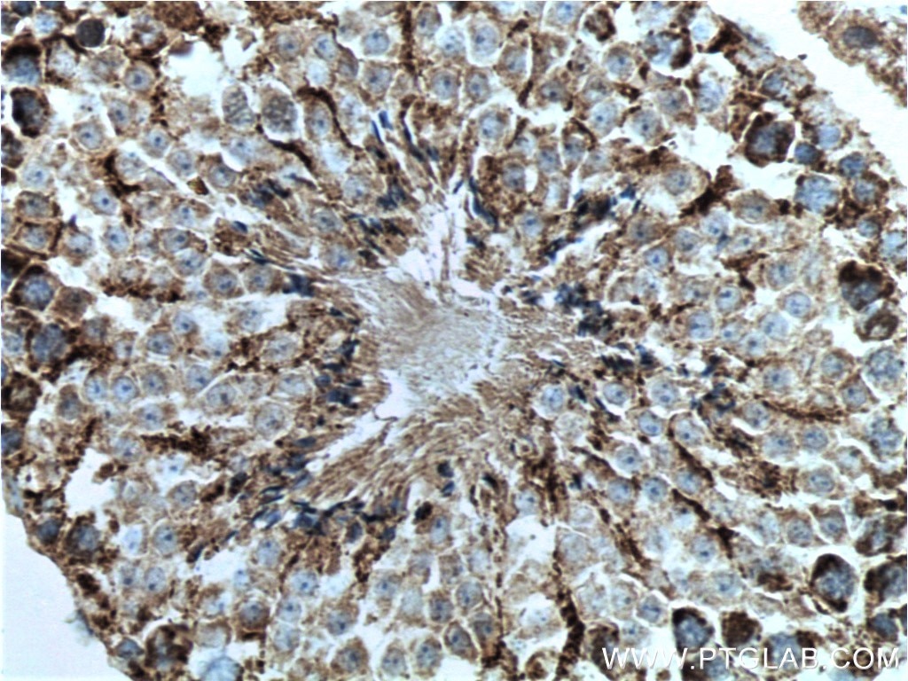 Immunohistochemistry (IHC) staining of mouse testis tissue using CHCHD4 Polyclonal antibody (21090-1-AP)