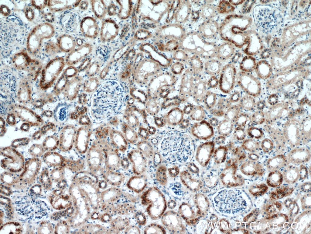 Immunohistochemistry (IHC) staining of human kidney tissue using CHCHD4 Polyclonal antibody (21090-1-AP)