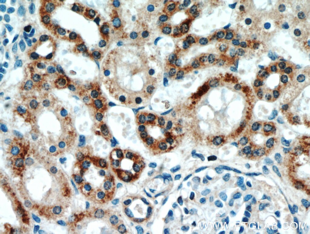 Immunohistochemistry (IHC) staining of human kidney tissue using CHCHD4 Polyclonal antibody (21090-1-AP)