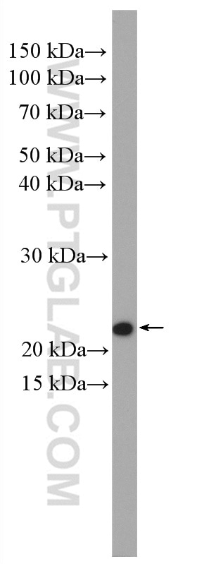 Western Blot (WB) analysis of Daudi cells using CHCHD4 Polyclonal antibody (21090-1-AP)