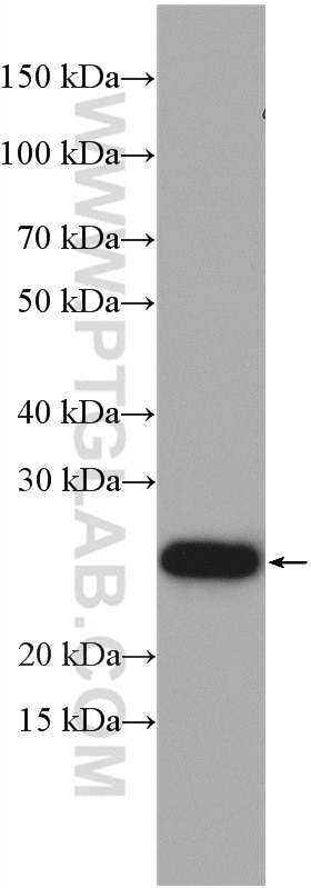 Western Blot (WB) analysis of rat brain tissue using CHCHD4 Polyclonal antibody (21090-1-AP)