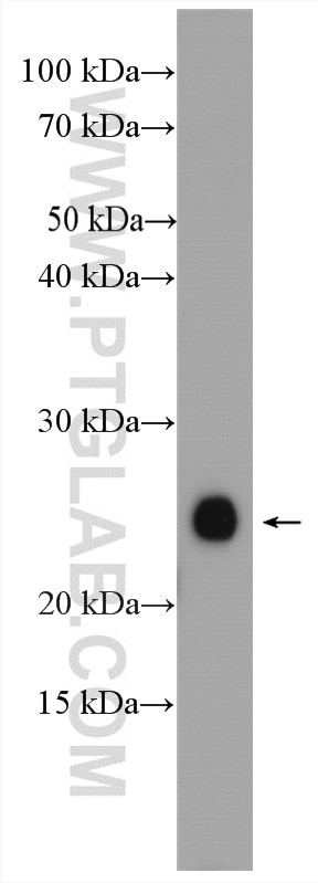 Western Blot (WB) analysis of mouse brain tissue using CHCHD4 Polyclonal antibody (21090-1-AP)