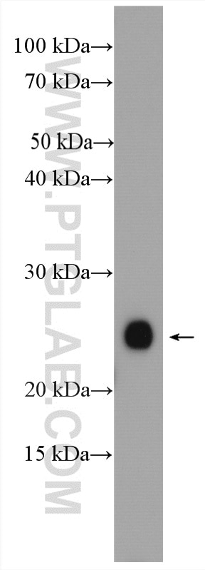 WB analysis of mouse brain using 21090-1-AP