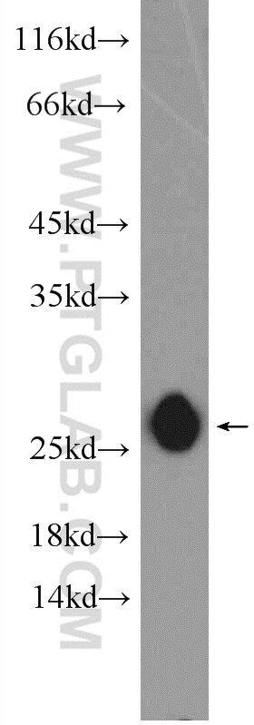 CHCHD4 Polyclonal antibody