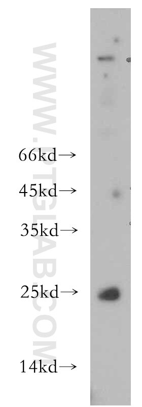 Western Blot (WB) analysis of mouse spleen tissue using CHCHD4 Polyclonal antibody (21090-1-AP)