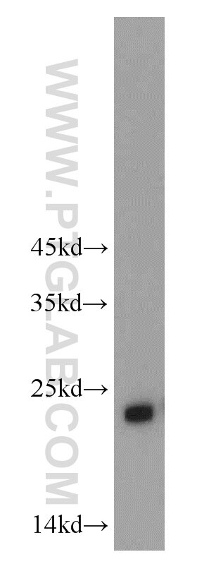 WB analysis of mouse kidney using 21090-1-AP