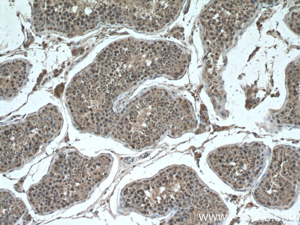 Immunohistochemistry (IHC) staining of human testis tissue using CHCHD4 Monoclonal antibody (66718-1-Ig)
