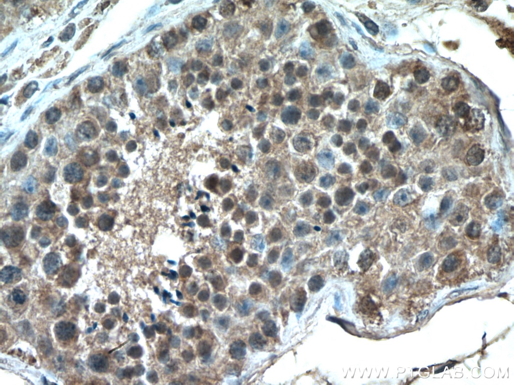 IHC staining of human testis using 66718-1-Ig