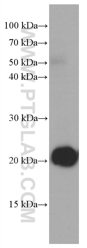 Western Blot (WB) analysis of rat brain tissue using CHCHD4 Monoclonal antibody (66718-1-Ig)