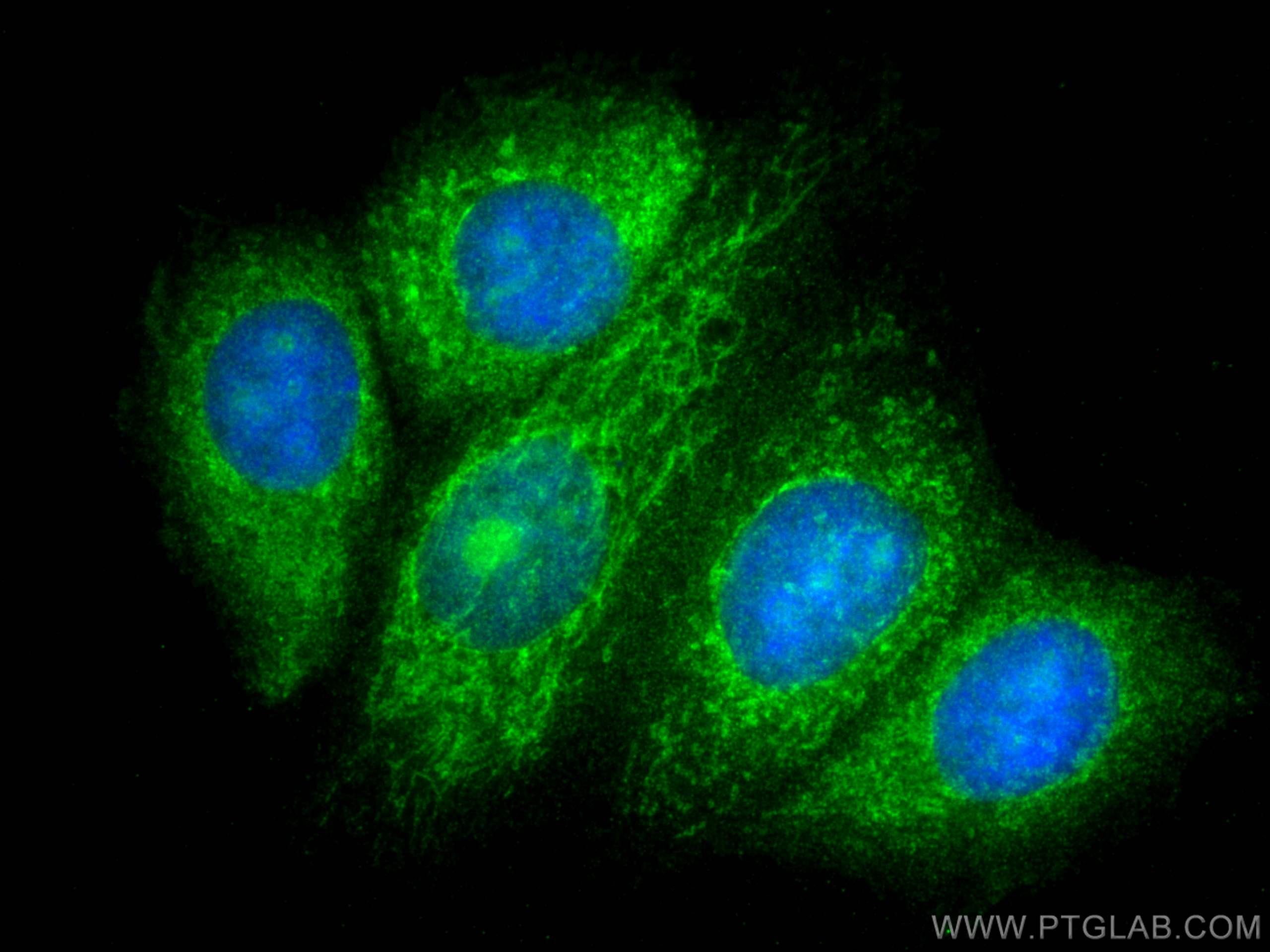 Immunofluorescence (IF) / fluorescent staining of MCF-7 cells using CHCHD6 Polyclonal antibody (20639-1-AP)