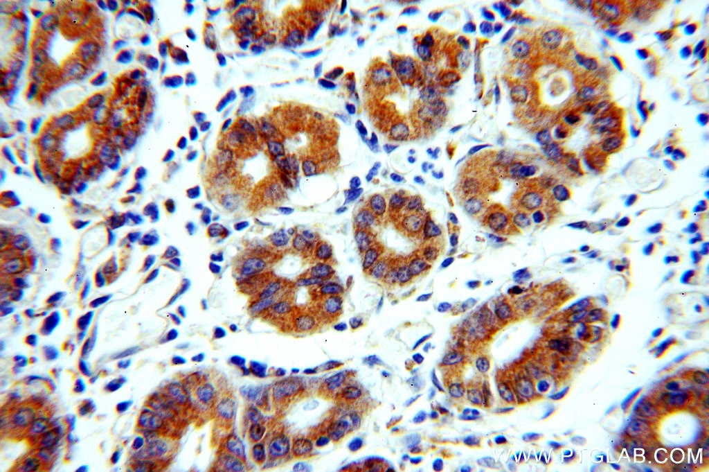 Immunohistochemistry (IHC) staining of human stomach tissue using CHCHD6 Polyclonal antibody (20639-1-AP)