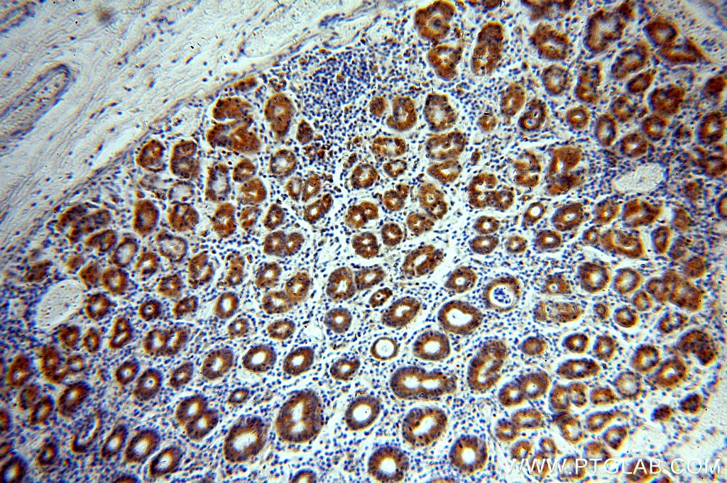 IHC staining of human stomach using 20639-1-AP