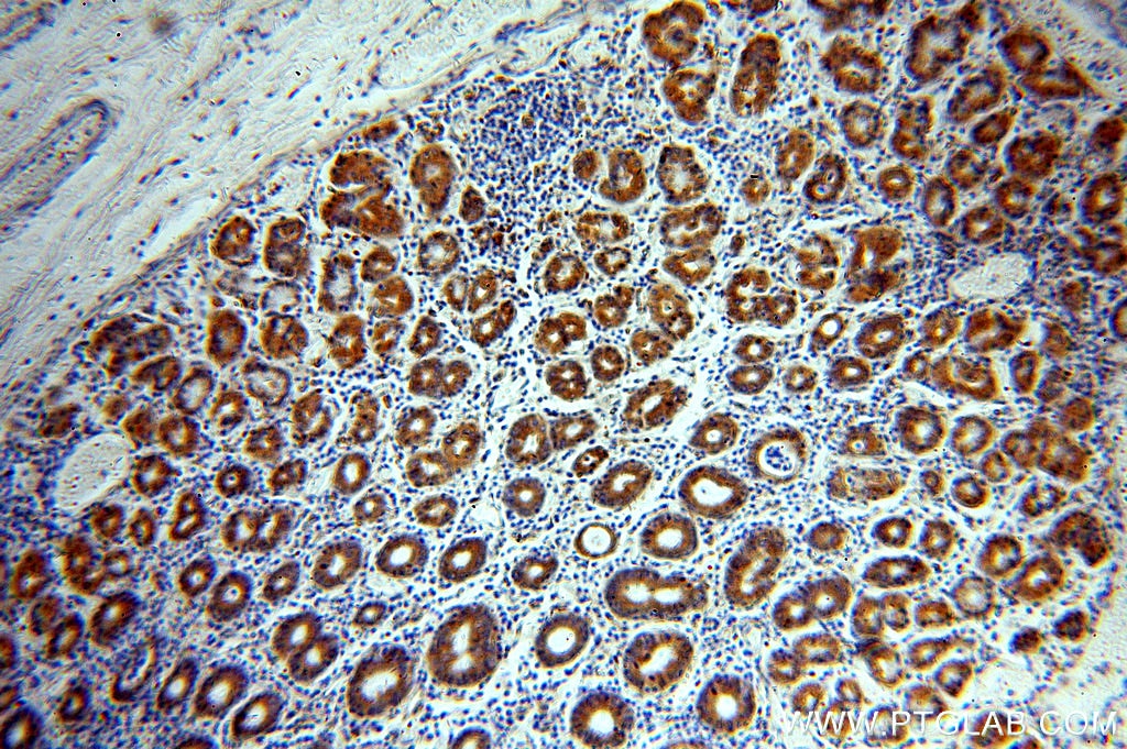 Immunohistochemistry (IHC) staining of human stomach tissue using CHCHD6 Polyclonal antibody (20639-1-AP)