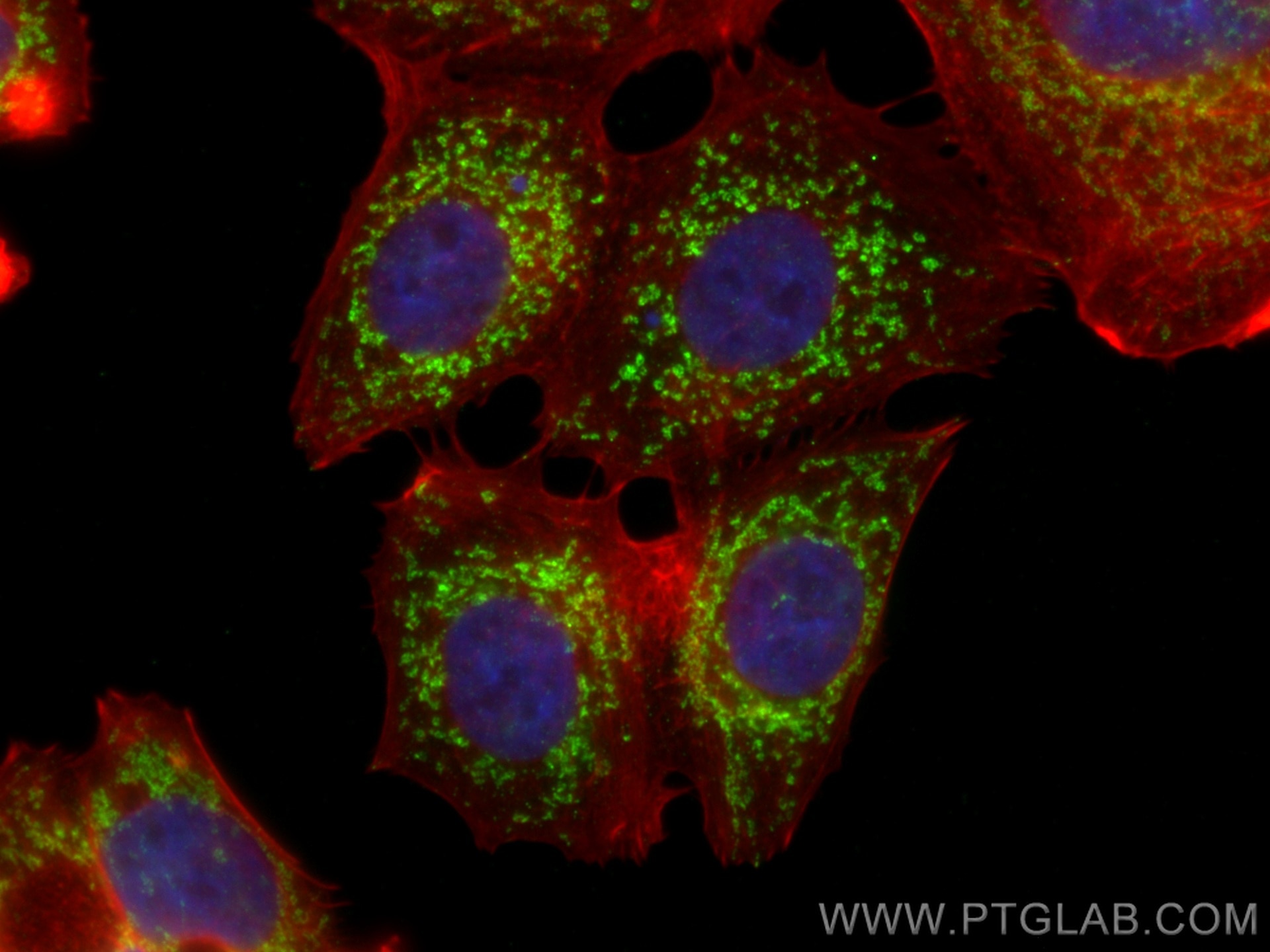 Immunofluorescence (IF) / fluorescent staining of MCF-7 cells using CHCHD6 Monoclonal antibody (66597-1-Ig)