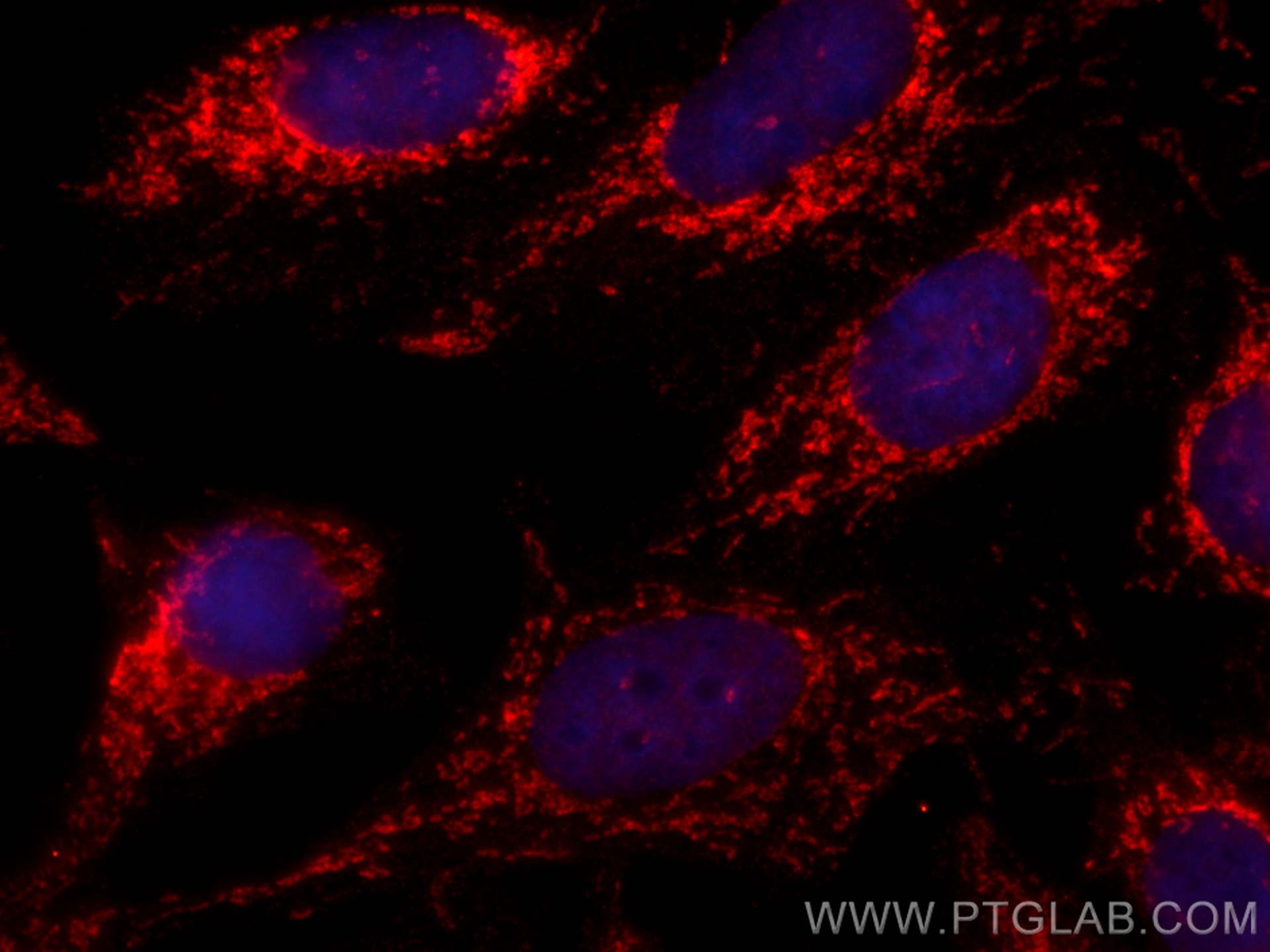 Immunofluorescence (IF) / fluorescent staining of MCF-7 cells using CoraLite®594-conjugated CHCHD6 Monoclonal antibody (CL594-66597)