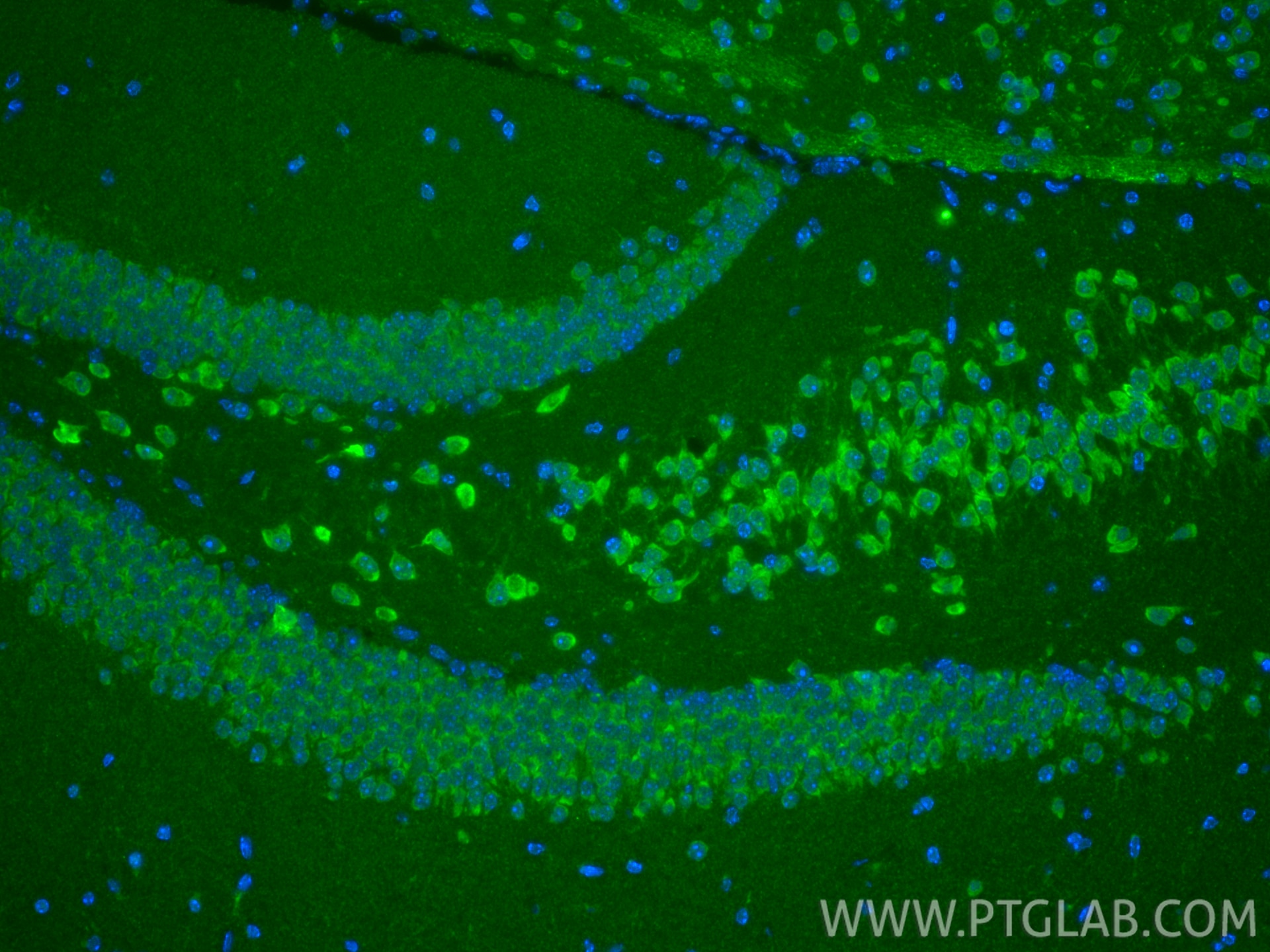 IF Staining of mouse brain using 19911-1-AP Immunofluorescence (IF) / fluorescent staining of mouse brain tissue using CHCHD7 Polyclonal antibody (19911-1-AP)
