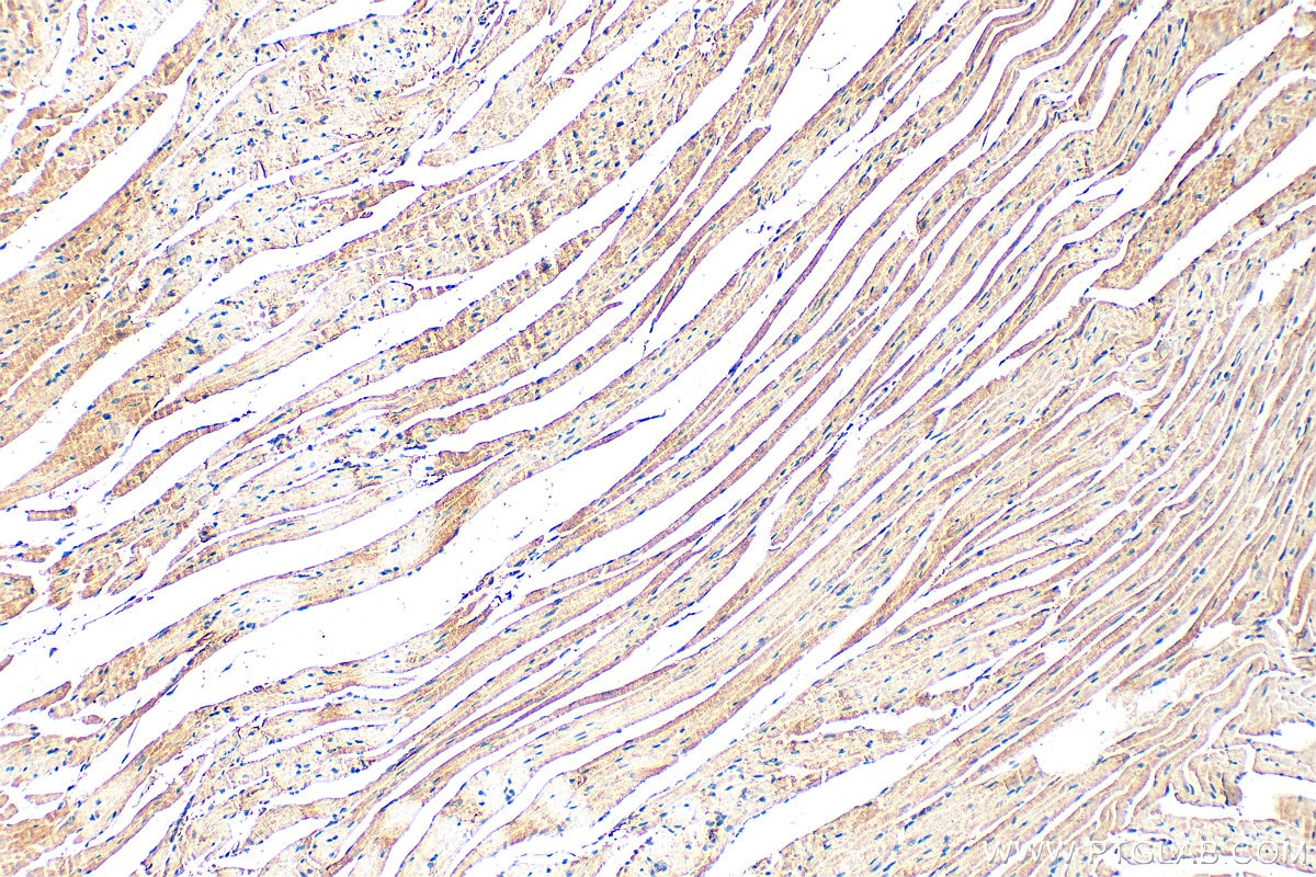 Immunohistochemistry (IHC) staining of mouse heart tissue using CHCHD7 Polyclonal antibody (19911-1-AP)