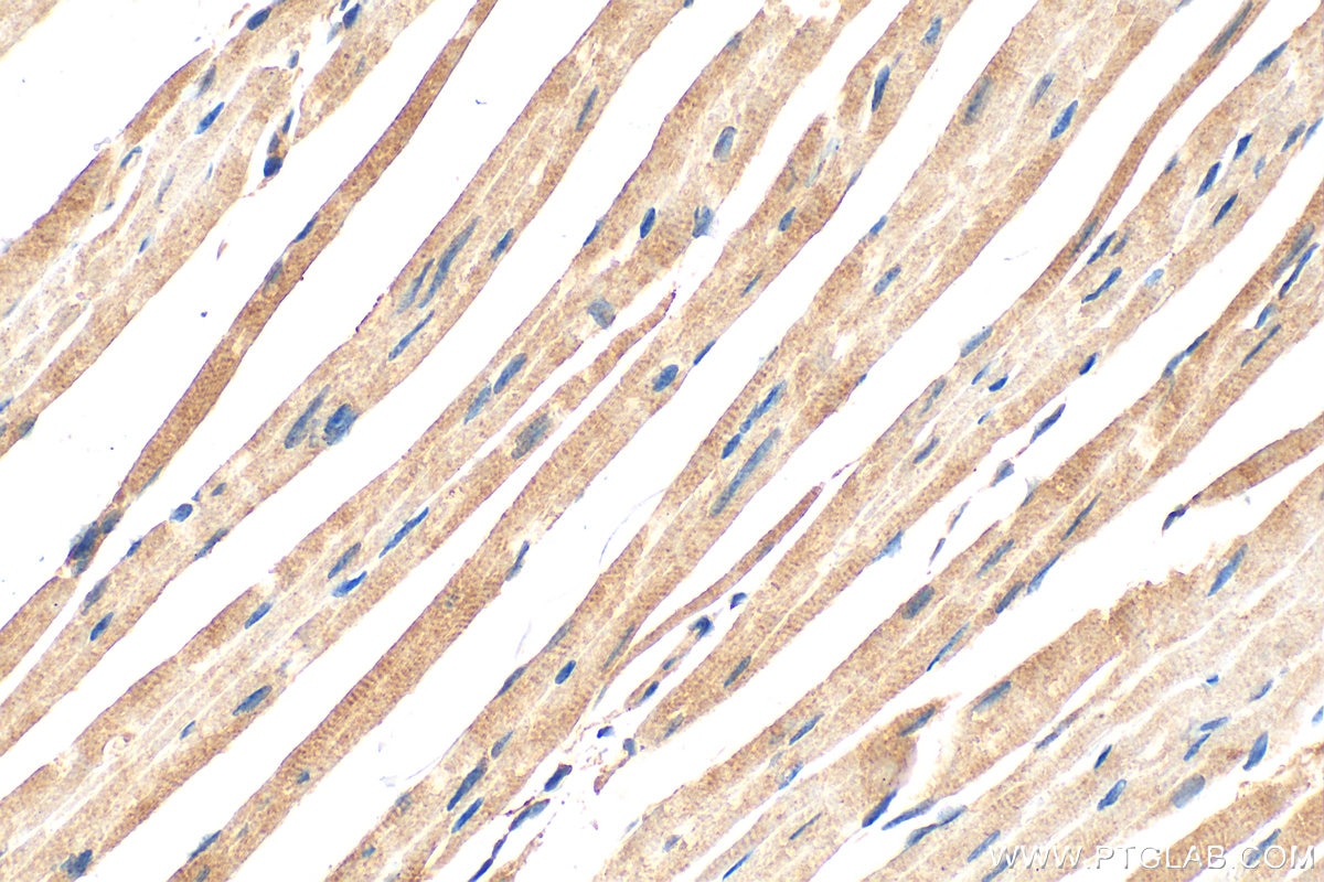 Immunohistochemistry (IHC) staining of mouse heart tissue using CHCHD7 Polyclonal antibody (19911-1-AP)