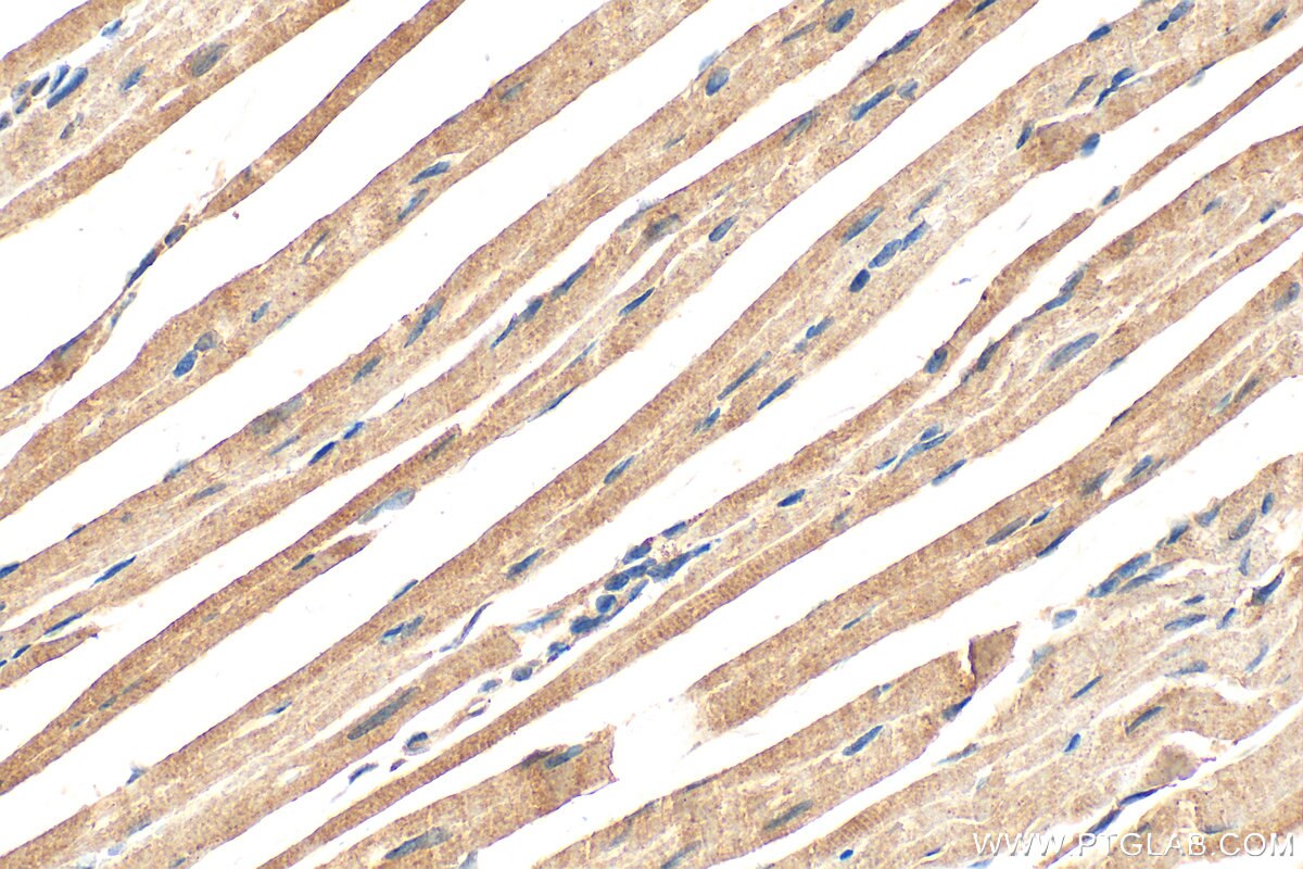 Immunohistochemical analysis of paraffin-embedded mouse heart tissue slide using 19911-1-AP (CHCHD7 antibody) at dilution of 1:200 (under 40x lens). Heat mediated antigen retrieval with Tris-EDTA buffer (pH 9.0). Immunohistochemistry (IHC) staining of mouse heart tissue using CHCHD7 Polyclonal antibody (19911-1-AP)