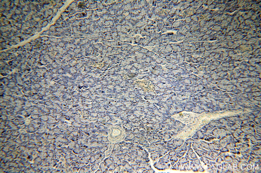 Immunohistochemistry (IHC) staining of human pancreas tissue using CHCHD7 Polyclonal antibody (19911-1-AP)