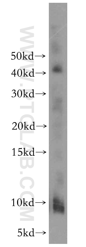 Western Blot (WB) analysis of human placenta tissue using CHCHD7 Polyclonal antibody (19911-1-AP)