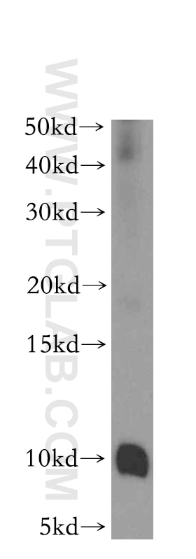 Western Blot (WB) analysis of mouse pancreas tissue using CHCHD7 Polyclonal antibody (19911-1-AP)