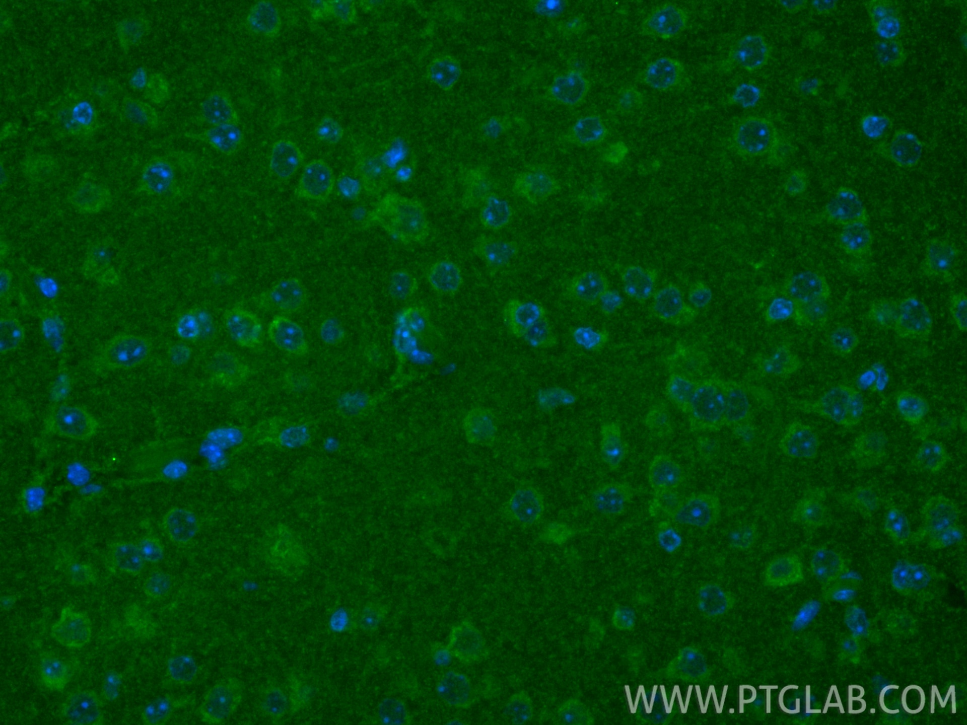 IF Staining of mouse brain using CL488-19911 Immunofluorescence (IF) / fluorescent staining of mouse brain tissue using CoraLite® Plus 488-conjugated CHCHD7 Polyclonal an (CL488-19911)