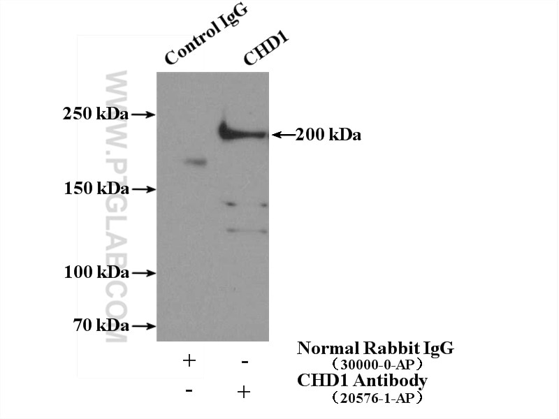 Immunoprecipitation (IP) experiment of HeLa cells using CHD1 Polyclonal antibody (20576-1-AP)