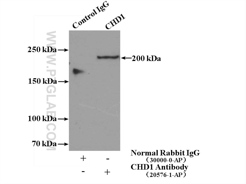 Immunoprecipitation (IP) experiment of HeLa cells using CHD1 Polyclonal antibody (20576-1-AP)