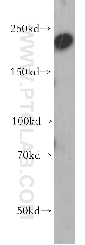 Western Blot (WB) analysis of human brain tissue using CHD1 Polyclonal antibody (20576-1-AP)