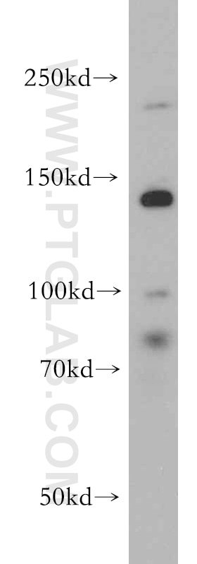 Western Blot (WB) analysis of HeLa cells using CHD1 Polyclonal antibody (20576-1-AP)