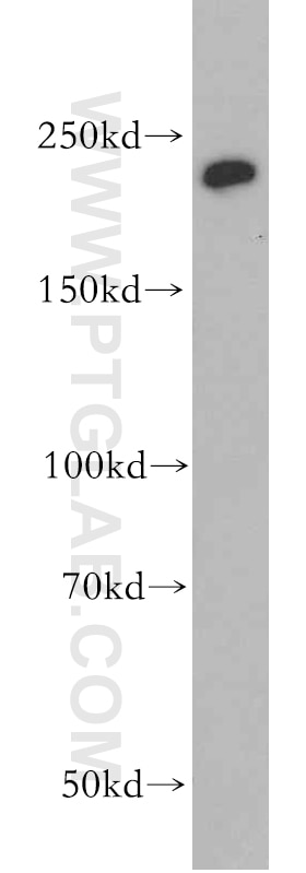 Western Blot (WB) analysis of HeLa cells using CHD1 Polyclonal antibody (20576-1-AP)