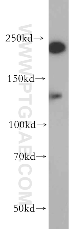 Western Blot (WB) analysis of A431 cells using CHD1 Polyclonal antibody (20576-1-AP)