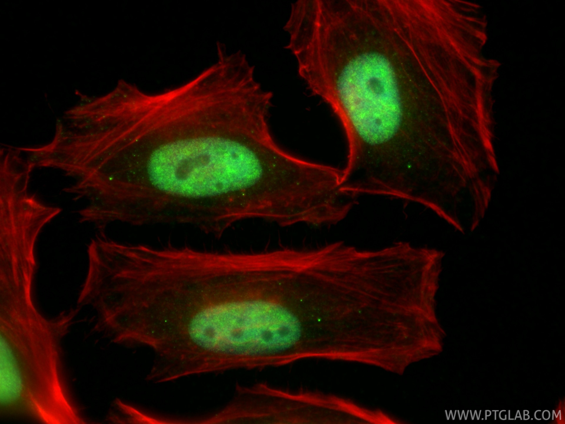 Immunofluorescence (IF) / fluorescent staining of HeLa cells using CHD1L Polyclonal antibody (32923-1-AP)