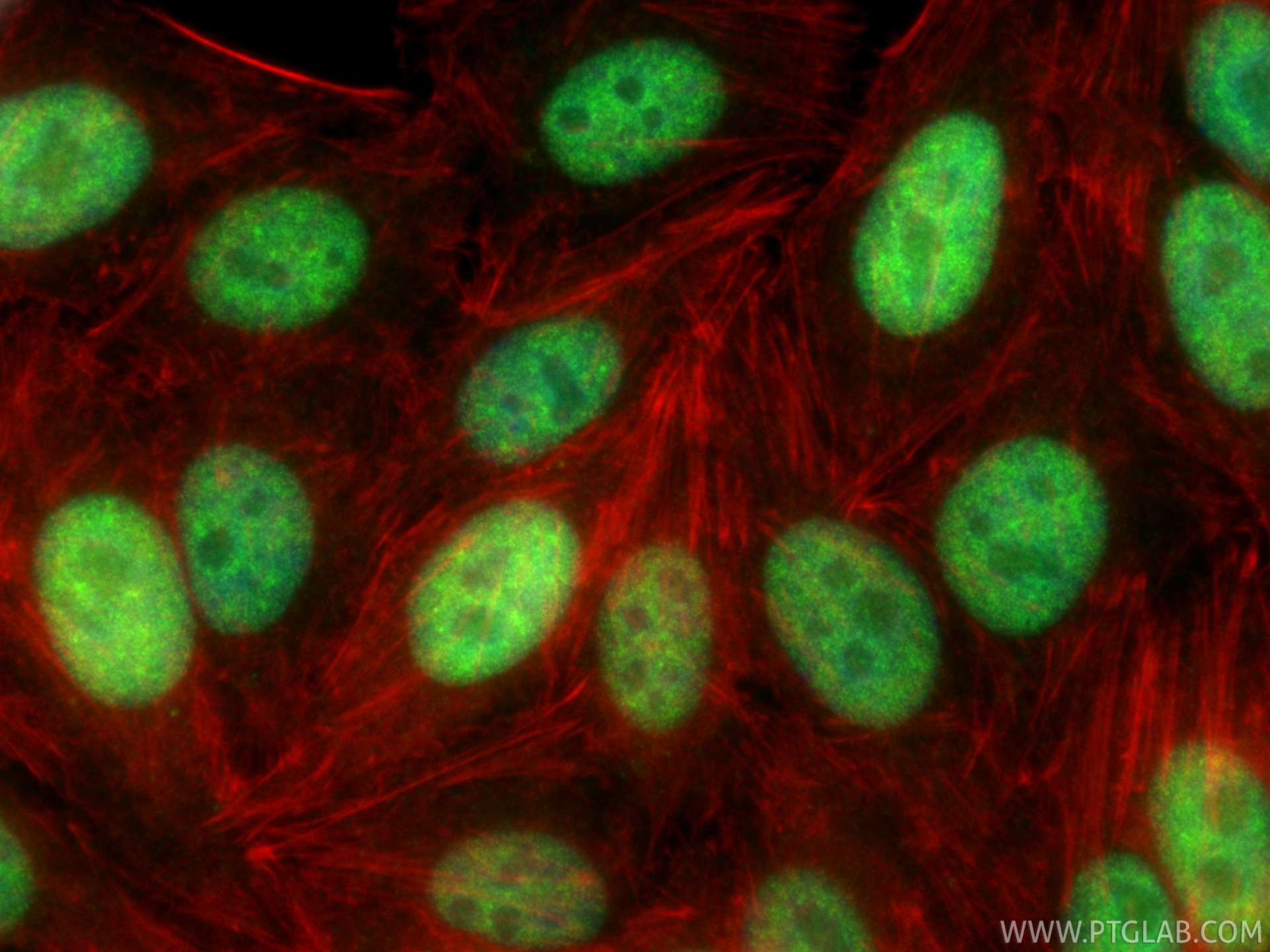 Immunofluorescence (IF) / fluorescent staining of HepG2 cells using CHD1L Polyclonal antibody (32923-1-AP)