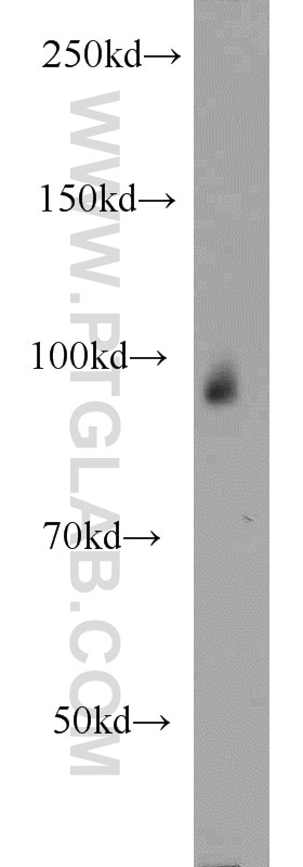 Western Blot (WB) analysis of human placenta tissue using CHD2 Polyclonal antibody (12311-1-AP)