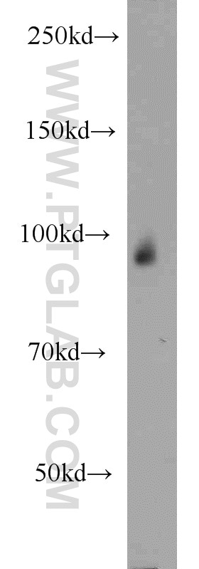 Western Blot (WB) analysis of human placenta tissue using CHD2 Polyclonal antibody (12311-1-AP)