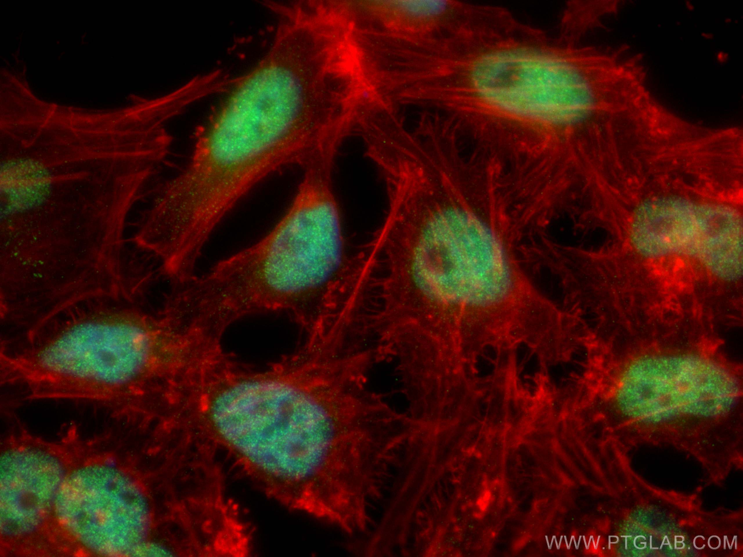 Immunofluorescence (IF) / fluorescent staining of HeLa cells using CHD2 Polyclonal antibody (21334-1-AP)