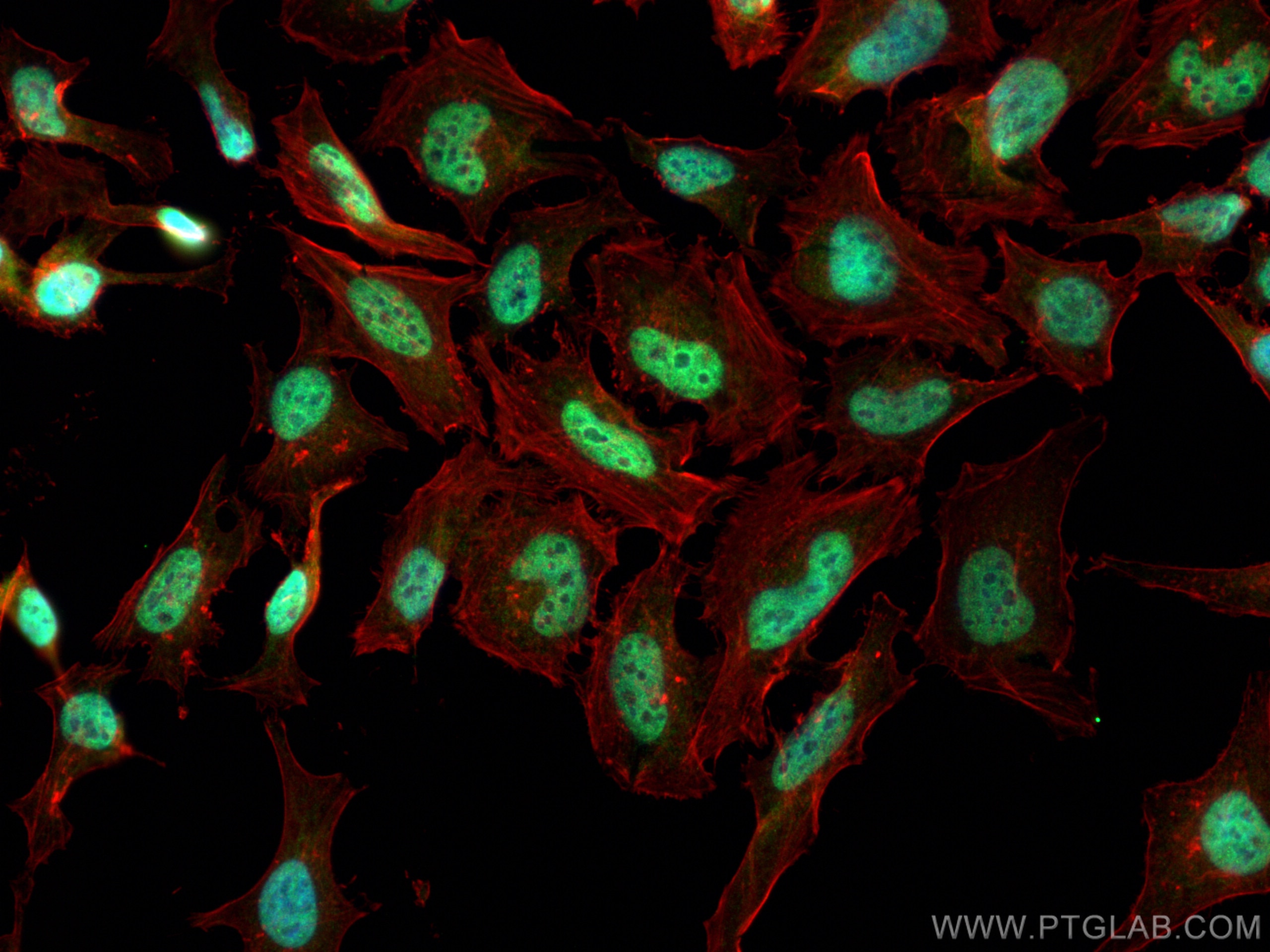 Immunofluorescence (IF) / fluorescent staining of HeLa cells using CHD2 Polyclonal antibody (21334-1-AP)