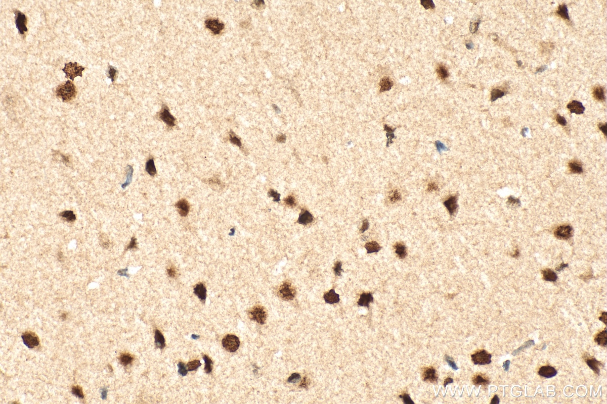 Immunohistochemistry (IHC) staining of rat brain tissue using CHD2 Polyclonal antibody (21334-1-AP)